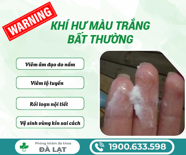 Hình ảnh minh họa